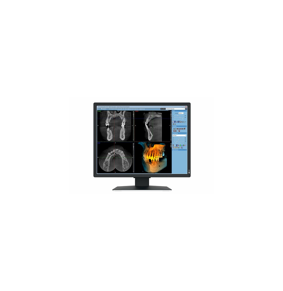 EIZO RadiForce MX217-SB Monitor PC 53,3 cm (21") 1200 x 1600 Pixel UXGA LCD Nero
